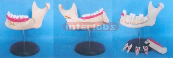 GIANT MANET TEETH AND LOWER JAW (GIANT DELUXE TEETH AND JAW MODEL)